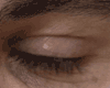 eye 02